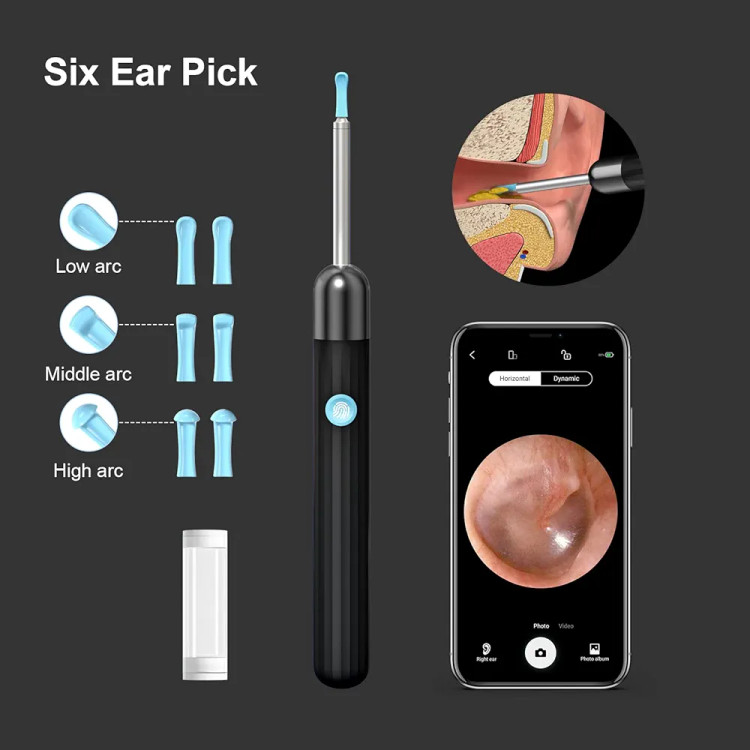 گوش پاک کن هوشمند دوربین دار EAR CLEANER