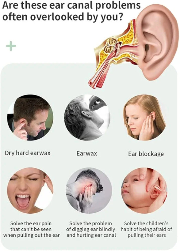 ساکشن گوش برای شست و شو ،شارژی، مدل EM1
