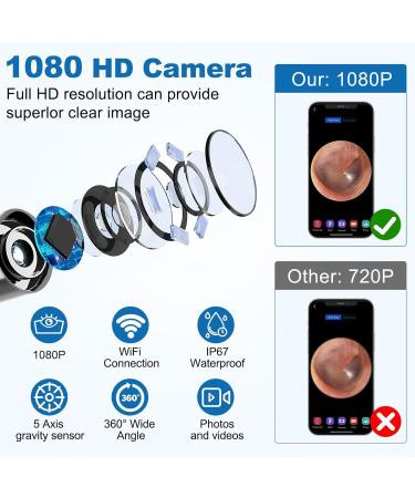 کیت تمیزکننده جرم گوش با دوربین Wolady، اوتوسکوپ بیسیم با کیفیت 1080P FHD، ضدآب IP64 با ۶ چراغ LED، قطر ۳.۶ میلیمتر، قابلحمل و سازگار با آیفون، آیپد و گوشیهای اندروید
