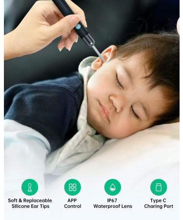 کیت تمیز کننده گوش دوربین دار قابل اتصال به موبایل از طریق اپلیکیشن